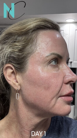 Nouvelle Cosmetics High quality cosmetic treatments