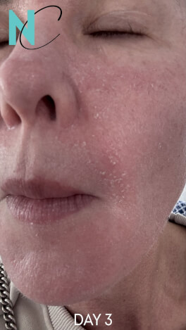 Nouvelle Cosmetics High quality cosmetic treatments
