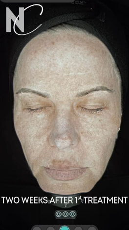 Nouvelle Cosmetics High quality cosmetic treatments